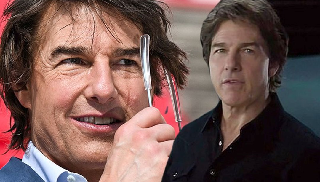 Tom Cruise’un yÃ¼zÃ¼ne ne oldu?